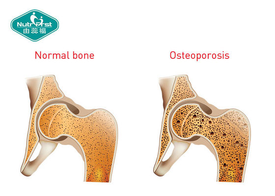 Calcium Vitamin D3 Tablet with Soybean Isoflavone for Improve Bone Health